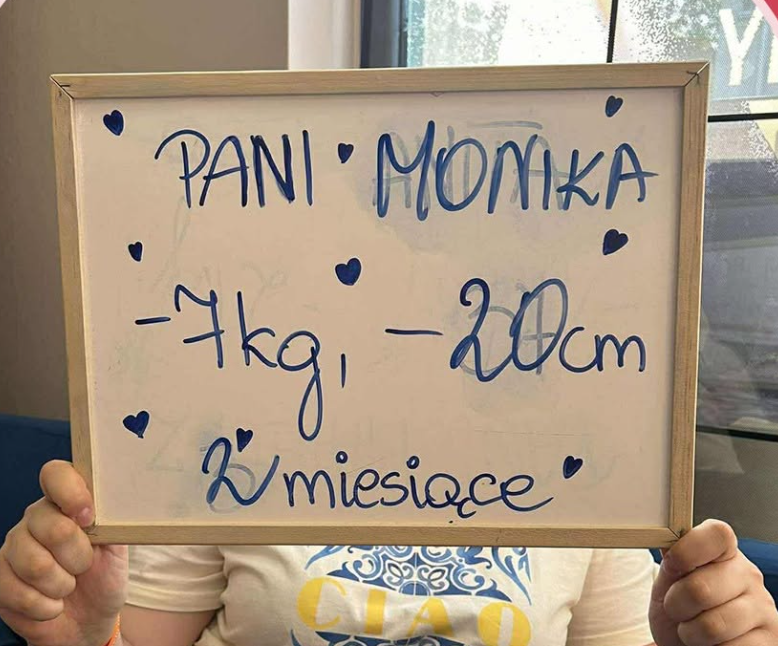 Efekt zabiegu kriolipolizy 2